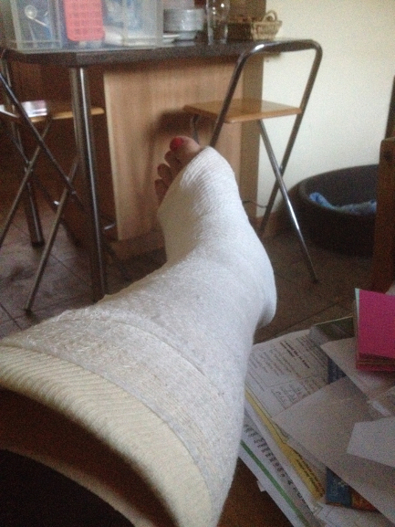 Foot in plaster, an accident and a summer of inactivity